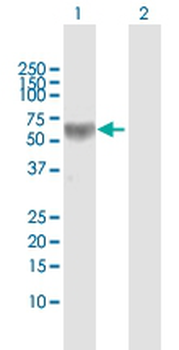 ALPP MaxPab rabbit polyclonal antibody (D01)