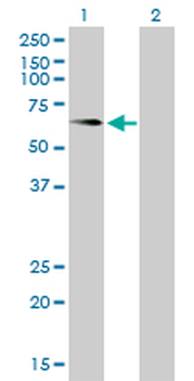 ALPL monoclonal antibody (M01), clone 4H1