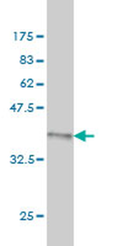 ALPL monoclonal antibody (M01), clone 4H1