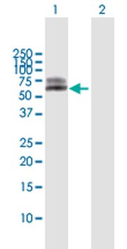 ALPL MaxPab rabbit polyclonal antibody (D01)