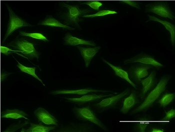 ALOX15B monoclonal antibody (M05), clone 4A7