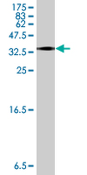 ALOX12B polyclonal antibody (A01)
