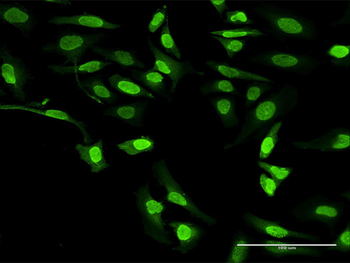 ALOX5 purified MaxPab rabbit polyclonal antibody (D01P)