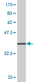 ALOX12 monoclonal antibody (M01), clone 2D10