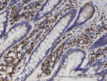 AKR1B1 monoclonal antibody (M03), clone 2D12