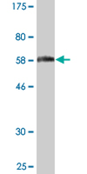 AKR1B1 monoclonal antibody (M03), clone 2D12