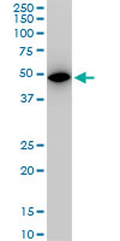 ALDOA monoclonal antibody (M03), clone 2E6
