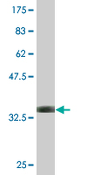 ALDOA monoclonal antibody (M03), clone 2E6