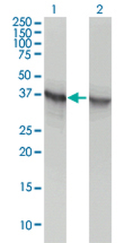 ALDOA monoclonal antibody (M02), clone 3C12-6D11