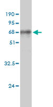 ALDOA monoclonal antibody (M02), clone 3C12-6D11