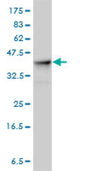 ALDOA monoclonal antibody (M01), clone 3D9-6F3