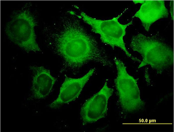 ALDOA monoclonal antibody (M01), clone 3D9-6F3