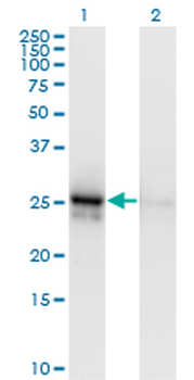 ALDOA monoclonal antibody (M01), clone 3D9-6F3