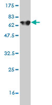 ALDOA monoclonal antibody (M01), clone 3D9-6F3
