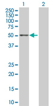 ALDH3A2 purified MaxPab rabbit polyclonal antibody (D01P)