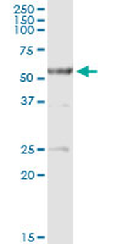 ALDH3A2 MaxPab rabbit polyclonal antibody (D01)