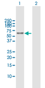 ALDH3A2 MaxPab rabbit polyclonal antibody (D01)