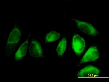 ALDH3A2 purified MaxPab mouse polyclonal antibody (B01P)