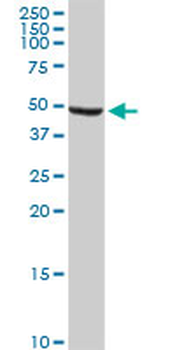 ALDH9A1 monoclonal antibody (M01), clone 3C6