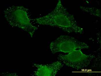 ALDH9A1 monoclonal antibody (M01), clone 3C6