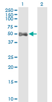 ALDH9A1 monoclonal antibody (M01), clone 3C6