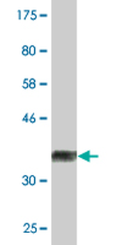 ALDH9A1 monoclonal antibody (M01), clone 3C6