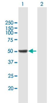 ALDH9A1 purified MaxPab mouse polyclonal antibody (B01P)