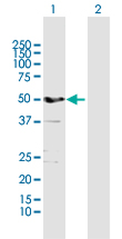 ALDH3A1 MaxPab rabbit polyclonal antibody (D01)