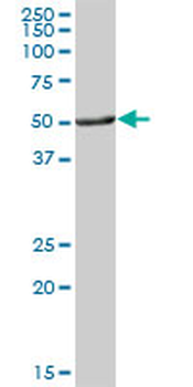 ALDH3A1 purified MaxPab mouse polyclonal antibody (B01P)