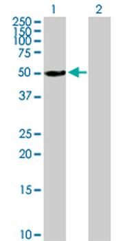 ALDH3A1 purified MaxPab mouse polyclonal antibody (B01P)