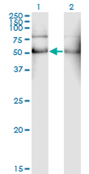 ALDH2 monoclonal antibody (M01), clone 1E5