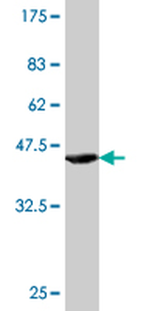 ALDH2 monoclonal antibody (M01), clone 1E5