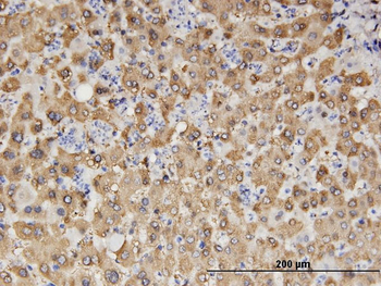 ALDH1A1 monoclonal antibody (M05), clone 1G6