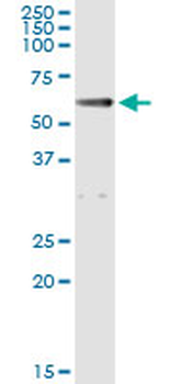 ALDH1A1 monoclonal antibody (M05), clone 1G6