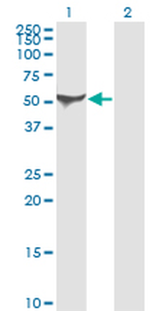 ALDH1A1 monoclonal antibody (M05), clone 1G6
