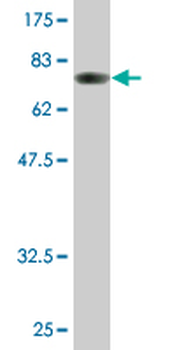 ALDH1A1 monoclonal antibody (M05), clone 1G6