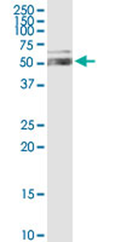 ALDH1A1 purified MaxPab rabbit polyclonal antibody (D01P)