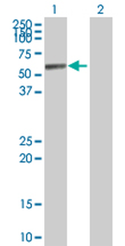 ALDH1A1 purified MaxPab rabbit polyclonal antibody (D01P)