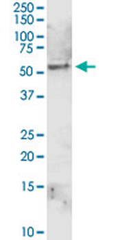 ALDH1A1 MaxPab rabbit polyclonal antibody (D01)