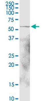 ALDH1A1 MaxPab rabbit polyclonal antibody (D01)