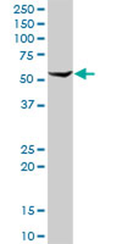 ALDH1A1 MaxPab rabbit polyclonal antibody (D01)