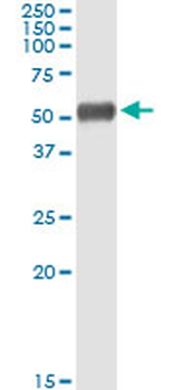 ALDH1A1 MaxPab rabbit polyclonal antibody (D01)