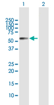 ALDH1A1 MaxPab rabbit polyclonal antibody (D01)