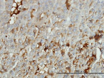 ALB monoclonal antibody (M01), clone 1G12-1B3