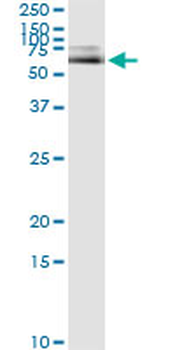 ALB monoclonal antibody (M01), clone 1G12-1B3