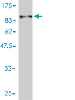 ALB monoclonal antibody (M01), clone 1G12-1B3