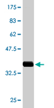 ALAS2 monoclonal antibody (M02), clone 4D8