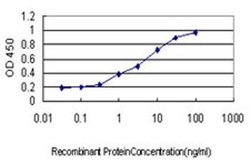 ALAS2 monoclonal antibody (M01), clone 6C1