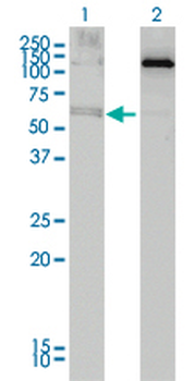 ALAS2 monoclonal antibody (M01), clone 6C1