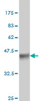 ALAS2 monoclonal antibody (M01), clone 6C1
